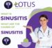 What is Sinusitis and what are the causes of Sinusitis.